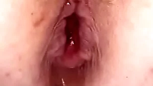 Anal bomb in my pain in the neck