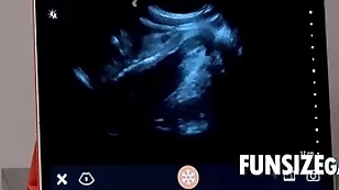 Ultra sound penetration surcease - dr wolf, austin