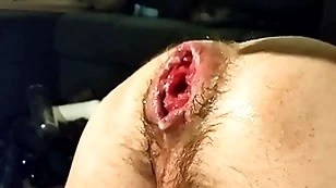 Only fisting my loose cleft and prolapse:)
