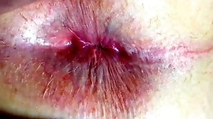 Ass and anus closeup