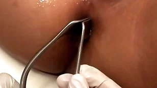 Asian patient penetrated in anal hole by stud in ayatollah
